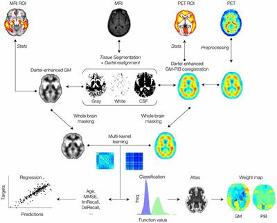 Multi-Kernel Learning with Dartel Improves Combined MRI-PET Classification of Alzheimer’s Disease in AIBL Data: Group and Individual Analyses